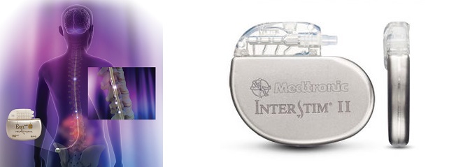 troubles neurologiques de l'incontinence urinaire