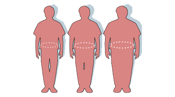 incontinence homme et surpoids